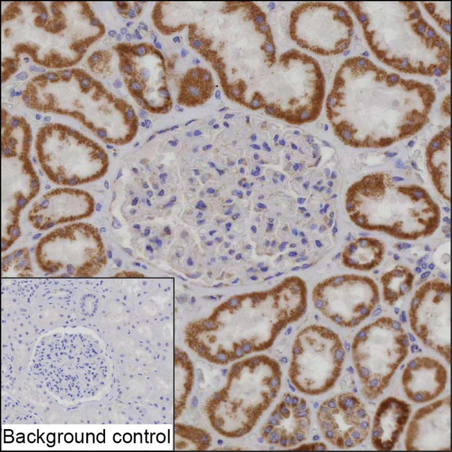NDUFA7 Antibody in Immunohistochemistry (Paraffin) (IHC (P))