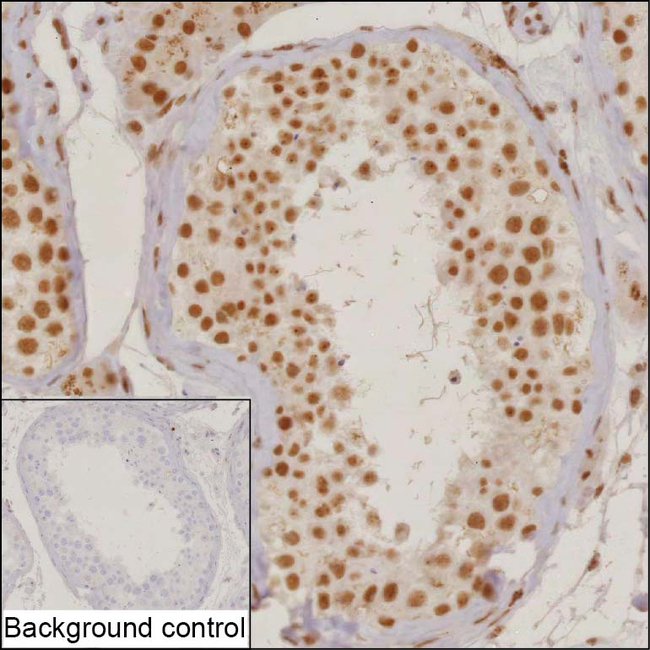 SF3A2 Antibody in Immunohistochemistry (Paraffin) (IHC (P))