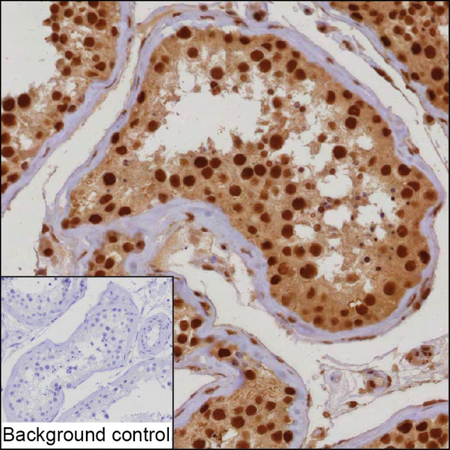 TH1L Antibody in Immunohistochemistry (Paraffin) (IHC (P))