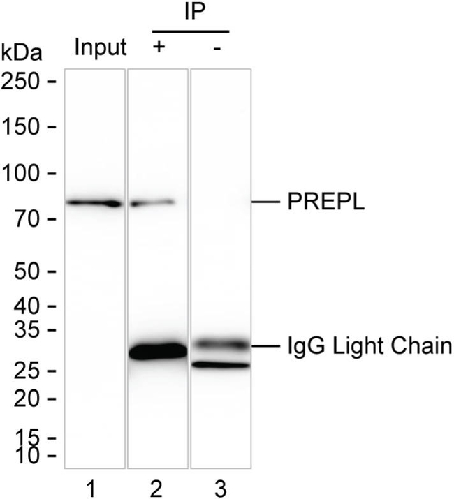 PREPL Antibody in Immunoprecipitation (IP)