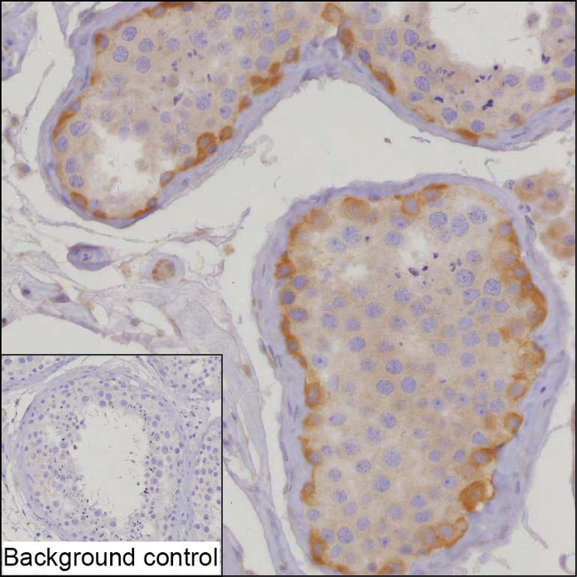 COPD Antibody in Immunohistochemistry (Paraffin) (IHC (P))