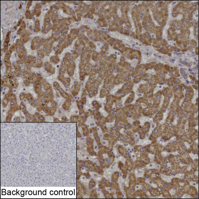 ALDH1B1 Antibody in Immunohistochemistry (Paraffin) (IHC (P))