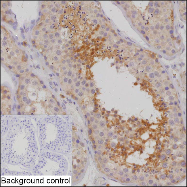 KIAA1211 Antibody in Immunohistochemistry (Paraffin) (IHC (P))