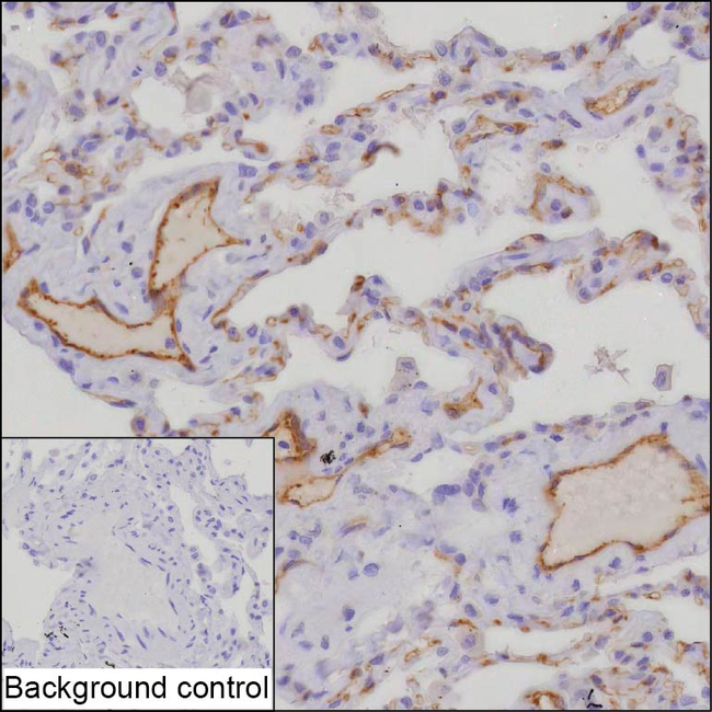RAMP2 Antibody in Immunohistochemistry (Paraffin) (IHC (P))