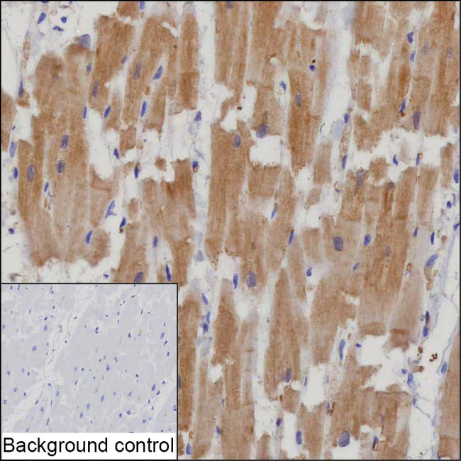 TMOD1 Antibody in Immunohistochemistry (Paraffin) (IHC (P))