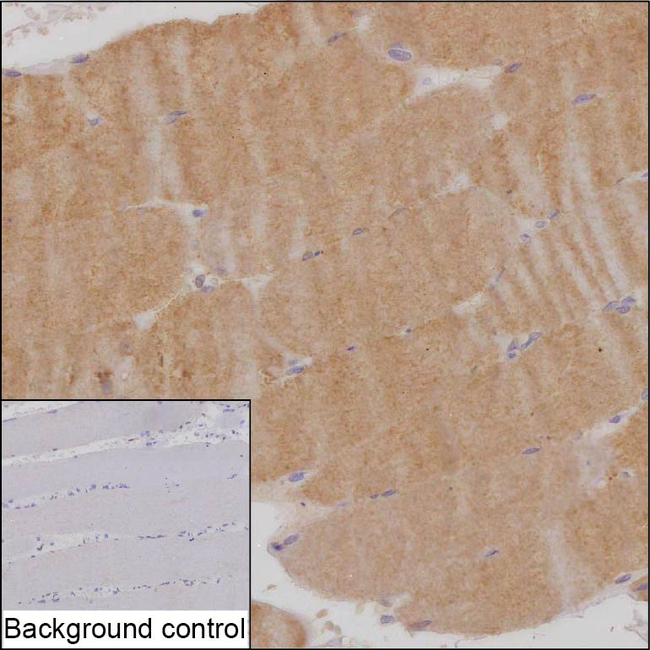 SMPX Antibody in Immunohistochemistry (Paraffin) (IHC (P))