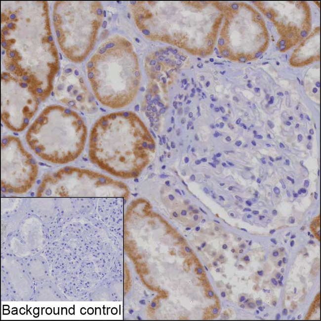 NDUFS5 Antibody in Immunohistochemistry (Paraffin) (IHC (P))