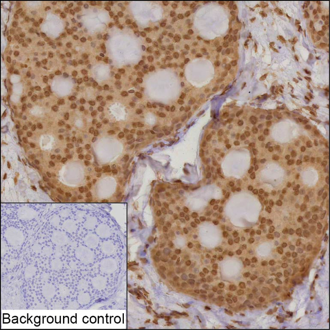 WDR70 Antibody in Immunohistochemistry (Paraffin) (IHC (P))
