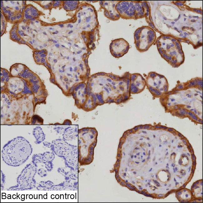 CD51 Antibody in Immunohistochemistry (Paraffin) (IHC (P))