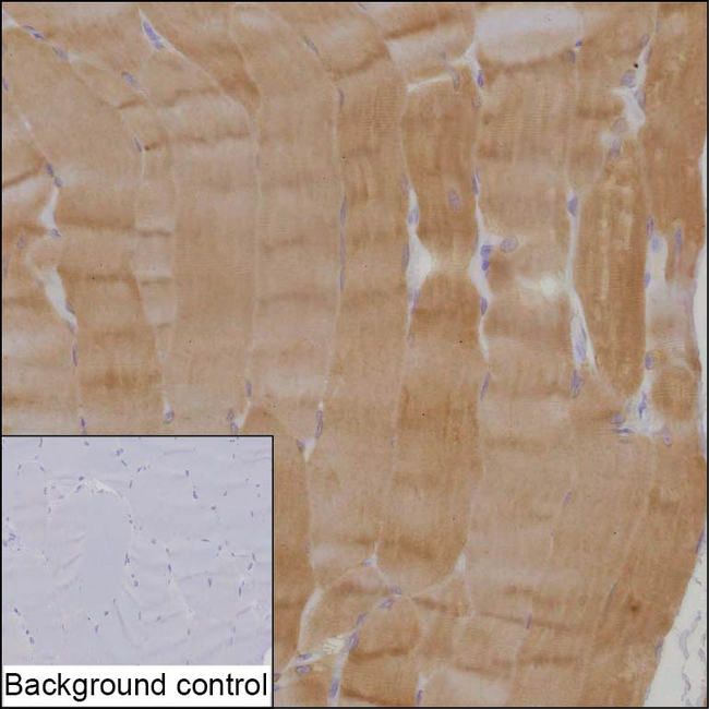 KLHL41 Antibody in Immunohistochemistry (Paraffin) (IHC (P))