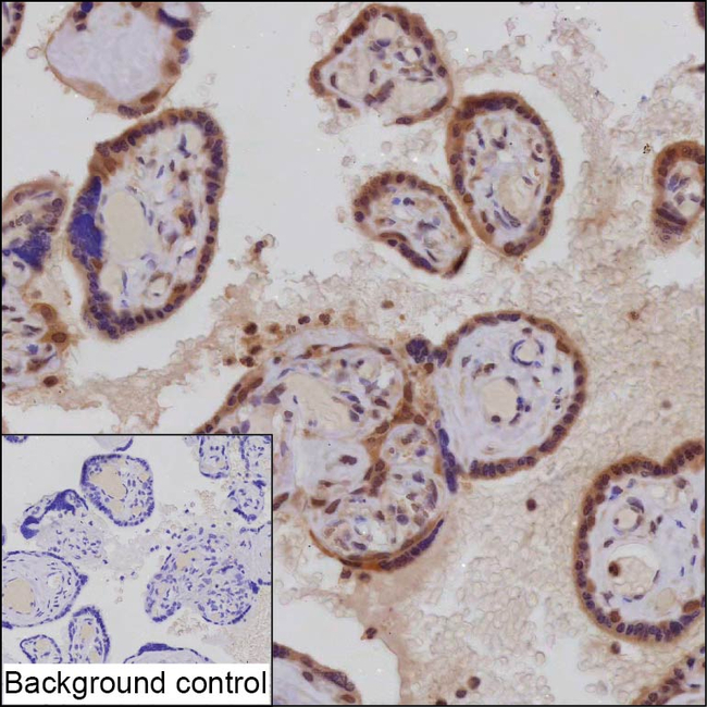 PSMD7 Antibody in Immunohistochemistry (Paraffin) (IHC (P))