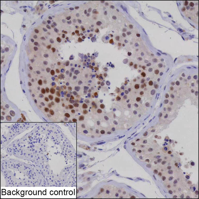WDR26 Antibody in Immunohistochemistry (Paraffin) (IHC (P))