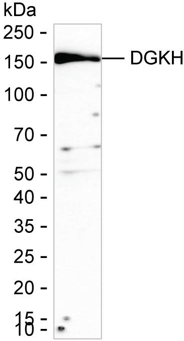 DGKH Antibody in Western Blot (WB)