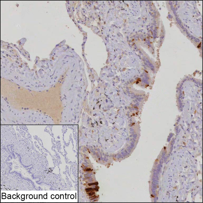 HIN-1 Antibody in Immunohistochemistry (Paraffin) (IHC (P))