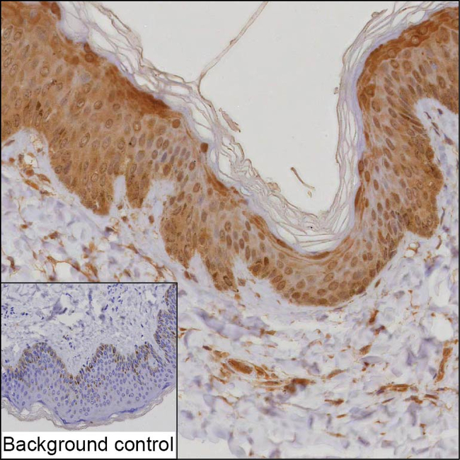 POMP Antibody in Immunohistochemistry (Paraffin) (IHC (P))