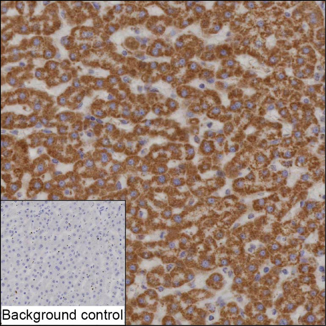 HADHB Antibody in Immunohistochemistry (Paraffin) (IHC (P))