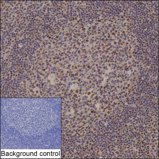 RNaseH2C Antibody in Immunohistochemistry (Paraffin) (IHC (P))