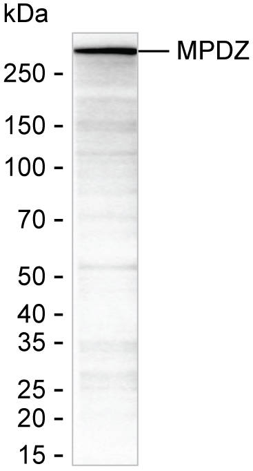 MUPP1 Antibody in Western Blot (WB)