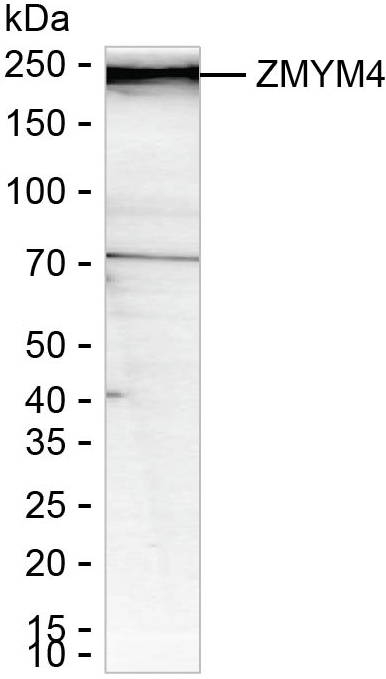 ZMYM4 Antibody in Western Blot (WB)