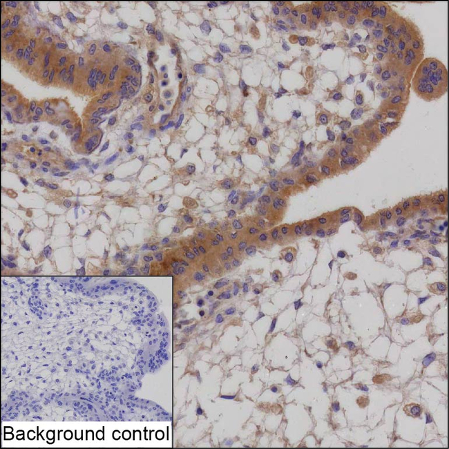 CTGF Antibody in Immunohistochemistry (Paraffin) (IHC (P))