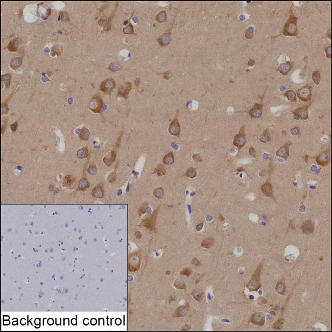 LRRC47 Antibody in Immunohistochemistry (Paraffin) (IHC (P))