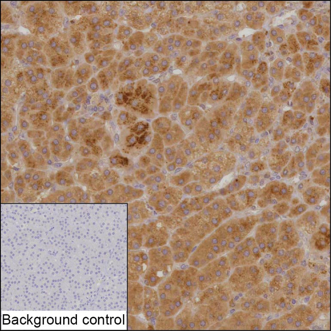 RABGGTB Antibody in Immunohistochemistry (Paraffin) (IHC (P))