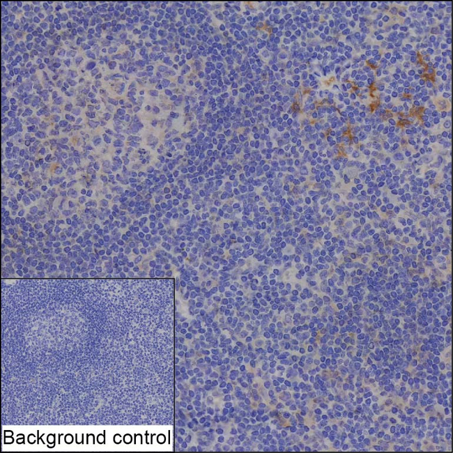 SNX11 Antibody in Immunohistochemistry (Paraffin) (IHC (P))