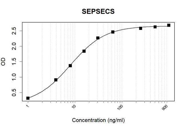 SLA/LP Antibody in ELISA (ELISA)