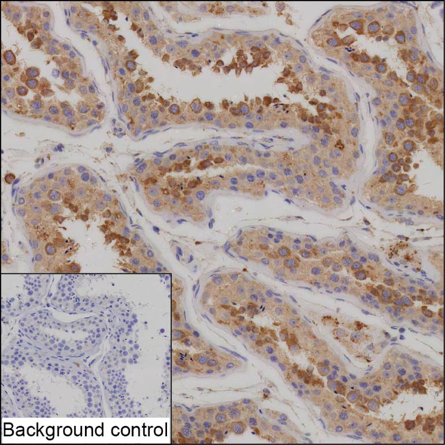 TXNDC3 Antibody in Immunohistochemistry (Paraffin) (IHC (P))