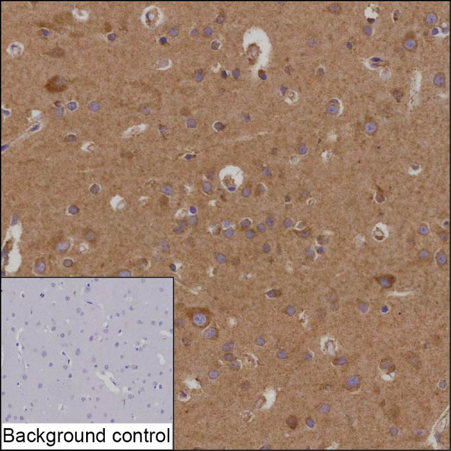 MTERFD3 Antibody in Immunohistochemistry (Paraffin) (IHC (P))