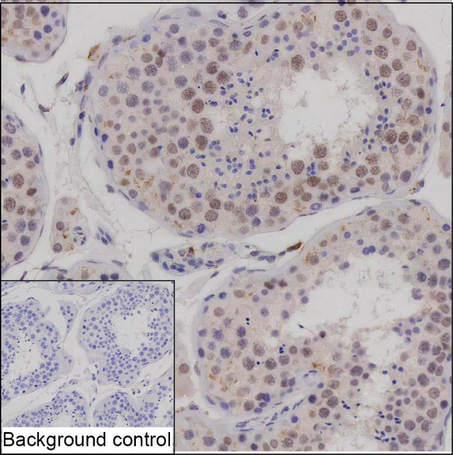 PHF10 Antibody in Immunohistochemistry (Paraffin) (IHC (P))