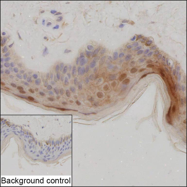 CTNNBIP1 Antibody in Immunohistochemistry (Paraffin) (IHC (P))