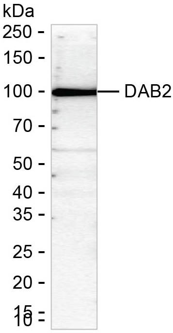 DAB2 Antibody in Western Blot (WB)