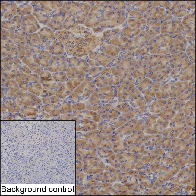 COPB2 Antibody in Immunohistochemistry (Paraffin) (IHC (P))