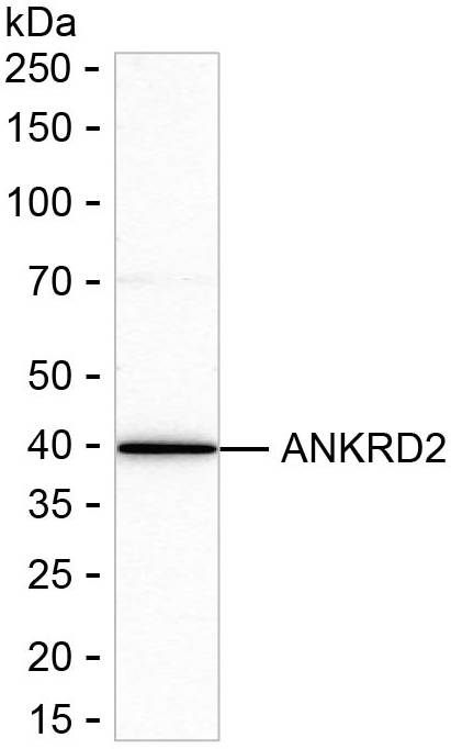 ANKRD2 Antibody in Western Blot (WB)