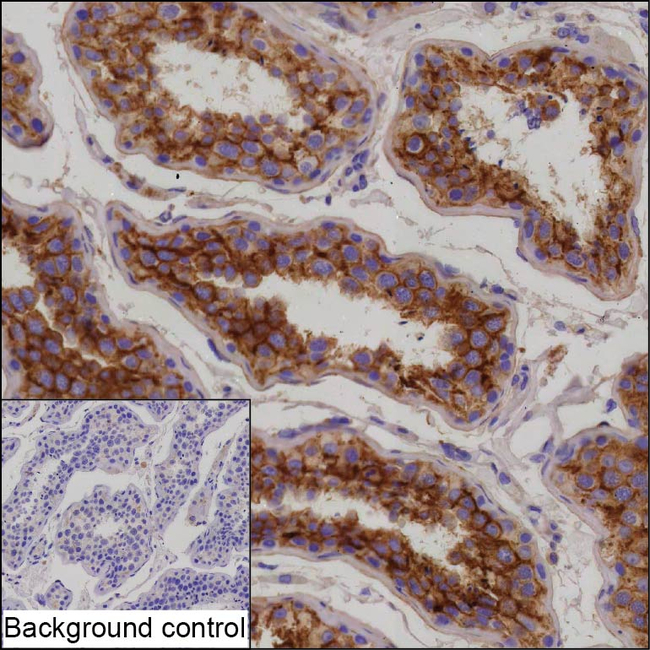AKAP12 Antibody in Immunohistochemistry (Paraffin) (IHC (P))