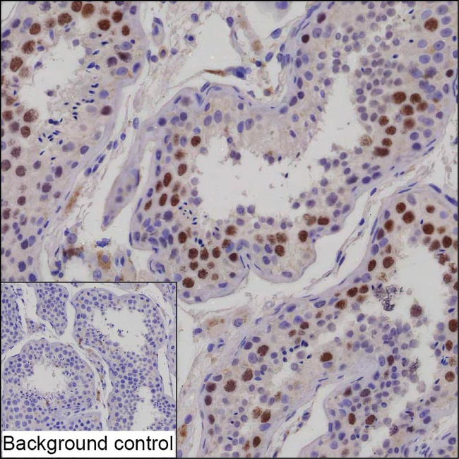 KIFC1 Antibody in Immunohistochemistry (Paraffin) (IHC (P))