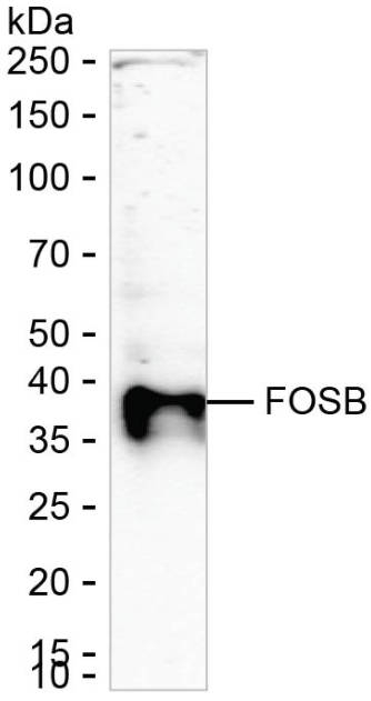 FosB Antibody in Western Blot (WB)