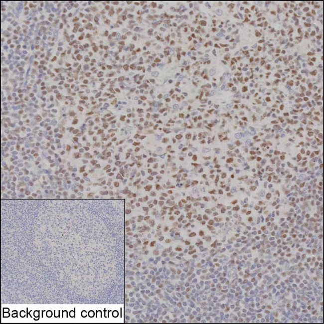 IKZF3 Antibody in Immunohistochemistry (Paraffin) (IHC (P))