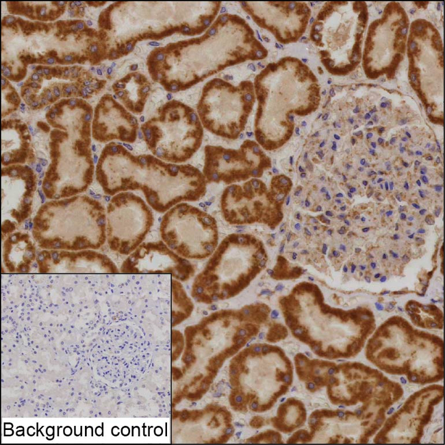 COA3 Antibody in Immunohistochemistry (Paraffin) (IHC (P))