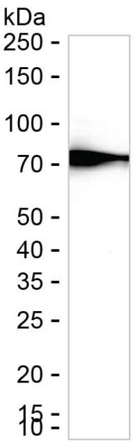 Epsin 3 Antibody in Western Blot (WB)