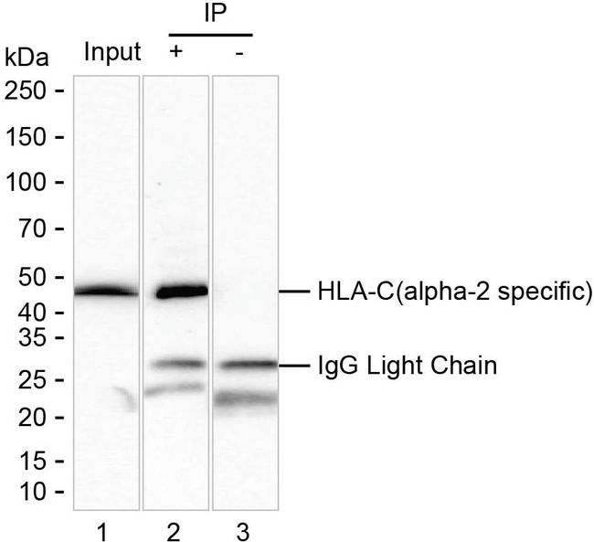 HLA-C Antibody in Immunoprecipitation (IP)