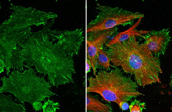 PD-L1 Antibody in Immunocytochemistry (ICC/IF)