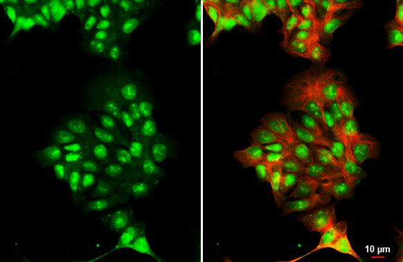 Androgen Receptor Antibody in Immunocytochemistry (ICC/IF)