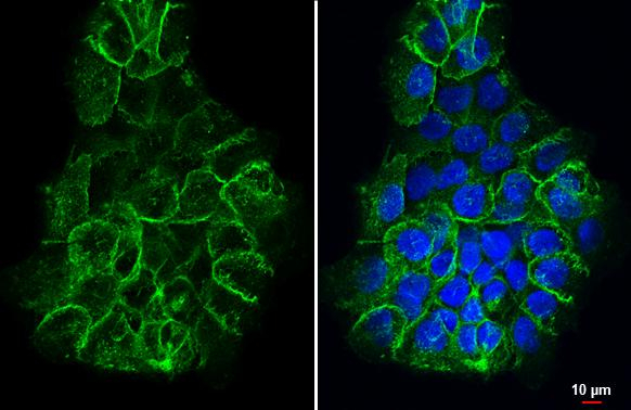 CD44 Antibody in Immunocytochemistry (ICC/IF)
