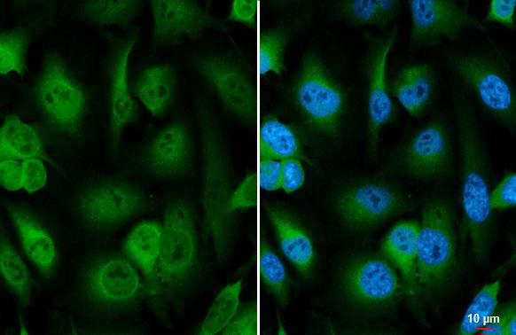 Galectin 3 Antibody in Immunocytochemistry (ICC/IF)