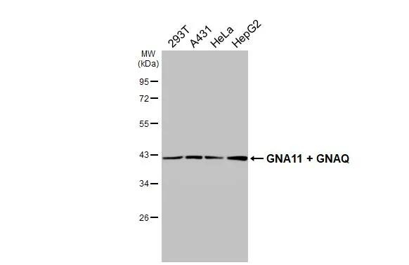 GNA11/GNAQ Antibody in Western Blot (WB)