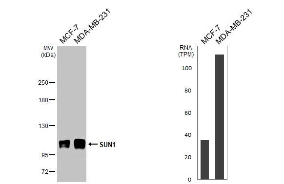 UNC84A Antibody in Western Blot (WB)