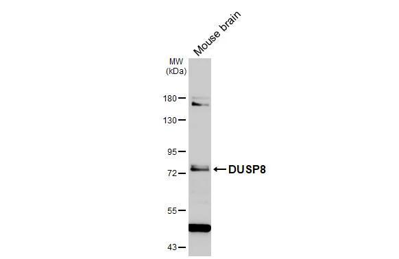 DUSP8 Antibody in Western Blot (WB)