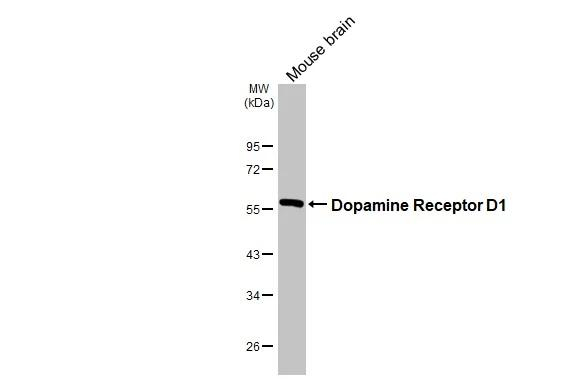 DRD1 Antibody in Western Blot (WB)